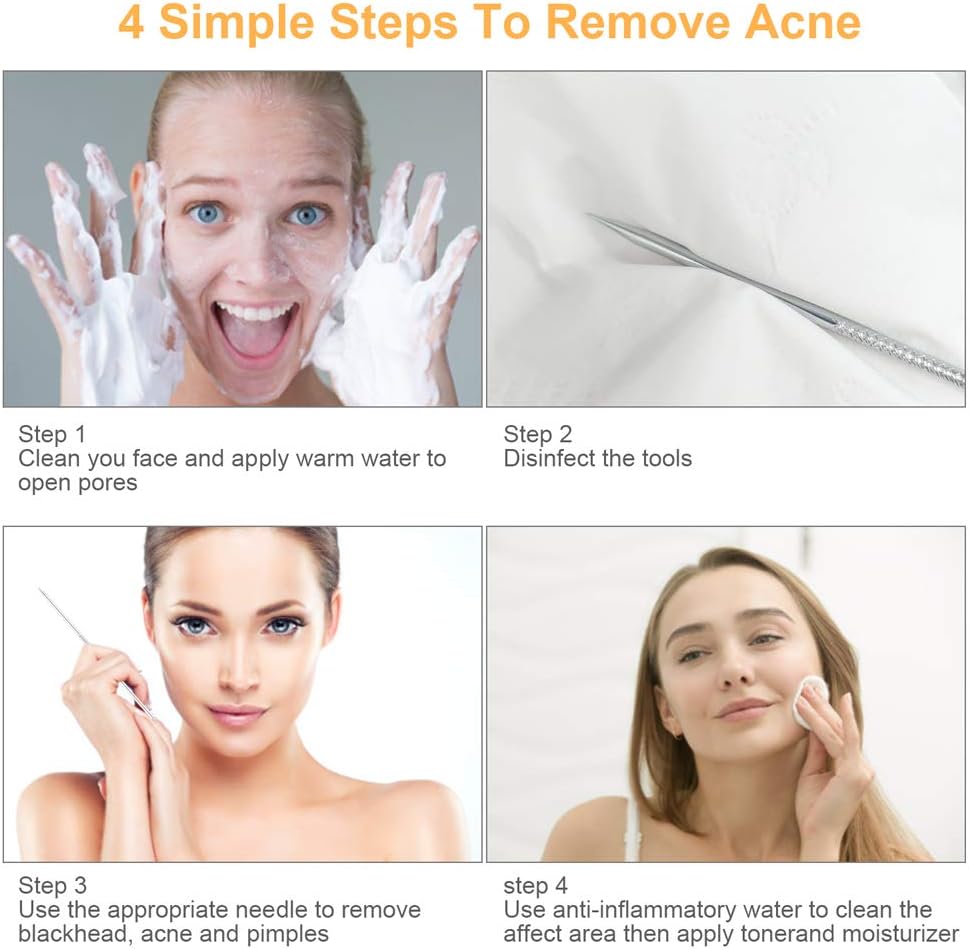 9 PCS Blackhead Remover Tools, Pimple Popper Tool Kit & Comedone Extractor - Professional Acne, Zit, Blemish & Whitehead Removal for Face & Nose, with Stainless Steel Tweezers & Travel Case, UUBAAR