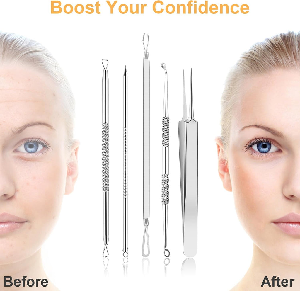 9 PCS Blackhead Remover Tools, Pimple Popper Tool Kit & Comedone Extractor - Professional Acne, Zit, Blemish & Whitehead Removal for Face & Nose, with Stainless Steel Tweezers & Travel Case, UUBAAR